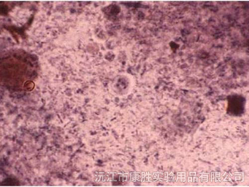 微小内蜒阿米巴包囊